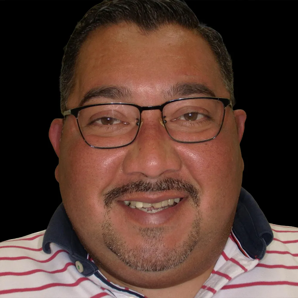 Before All-on-4 Procedure